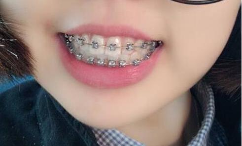 女生變漂亮的8個小常識！絕對好用
