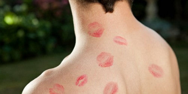 吻痕怎麼快速消除 教你13個消除吻痕的妙招