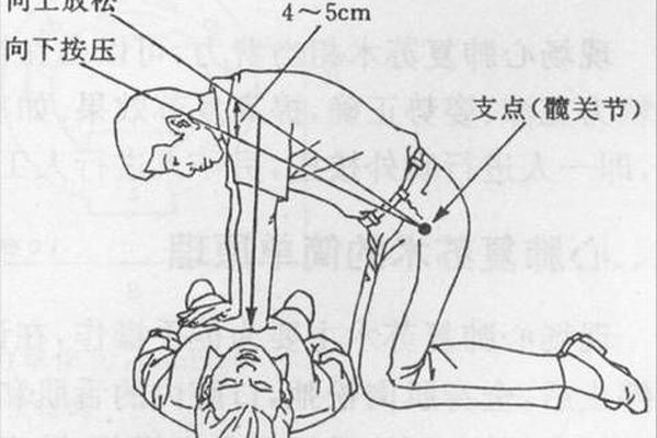 生活中常見的急救誤區 你犯了嗎？