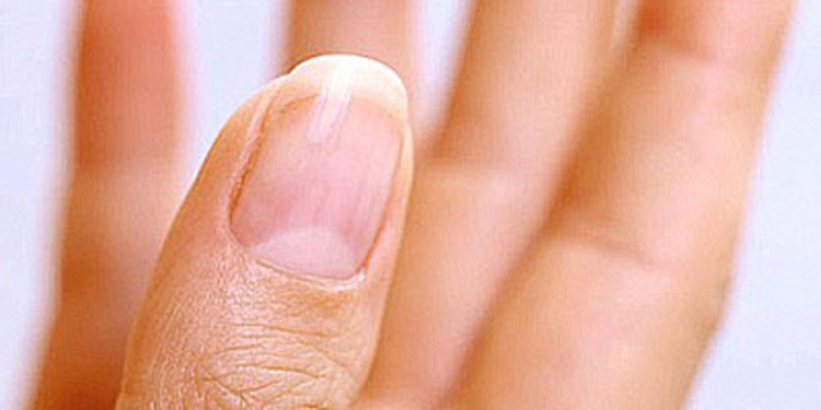 指甲上的半月痕你懂多少 與身體健康有密切關系