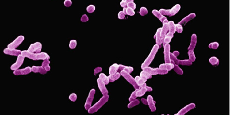 家庭細菌的危害 盤點十大家庭細菌聚集地