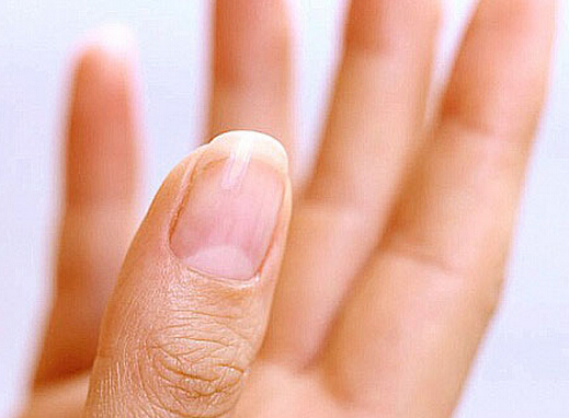 手指甲上的月牙是怎麼回事？半月痕與五指關系