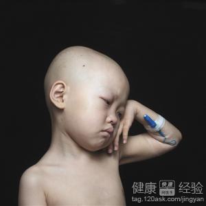 放化療病人吃什麼好推薦三種營養食物