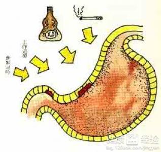 健脾胃、治胃痛的5種好食物