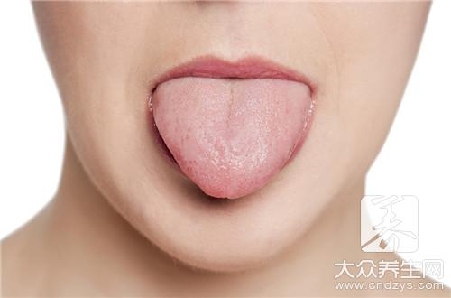 舌頭潰瘍忌口 7個飲食禁忌