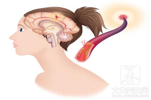 吸煙加速大腦衰老？五個可怕因素讓你提前”退化“(6)