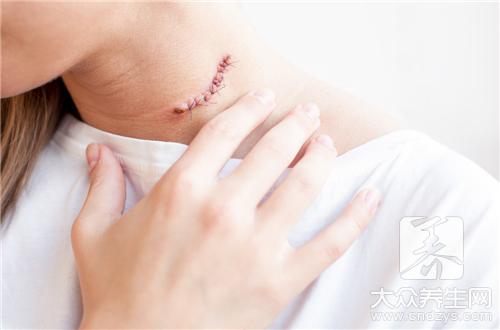 脖子右側淋巴結疼痛要注意什麼呢？(1)